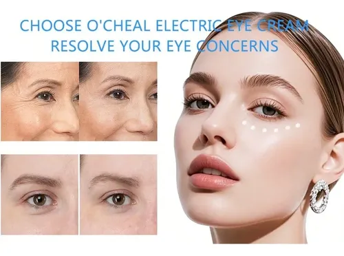 Crema Para Ojos Nad+retinol, Puede Reducir Las Líneas Finas  Todo Tipo De Piel Día/noche