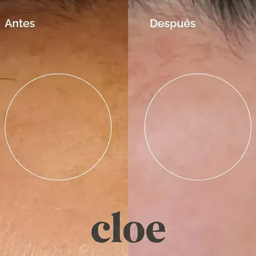 Loción Exfoliante Antimancha Con Ácido Glicólico Cloe 75 Ml