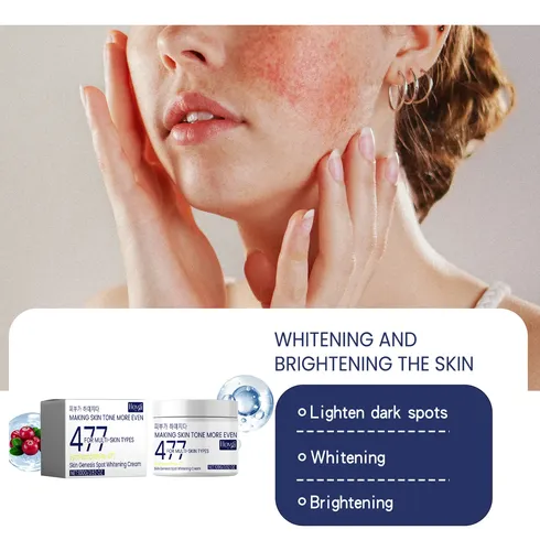 Hy/ Crema Iluminadora Para Decolorar Manchas Hoygi