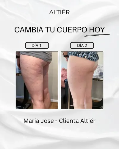 Crema Corporal Altiér Anti-celulitis Piernas Relajadas 230ml Neutra
