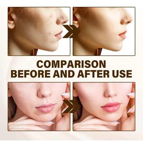 Base De Maquillaje Líquida Radiance Cálida C