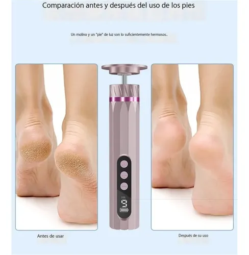 Lima Elétrica 9 Velocidades Para Pés E Mãos Pink J Rosa