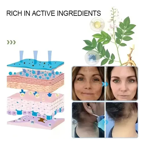 Gel Exfoliante Blanqueador Limpieza Profunda Reducción 5pcs