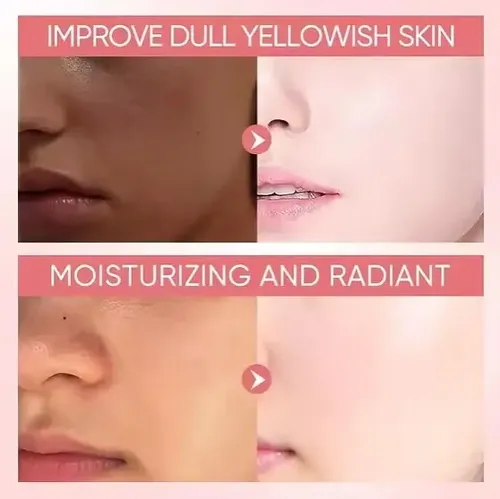 Crema Niacinamida Bioaqua – Ml A Momento De Aplicación Día/noche Tipo De Piel Todo Tipo De Piel