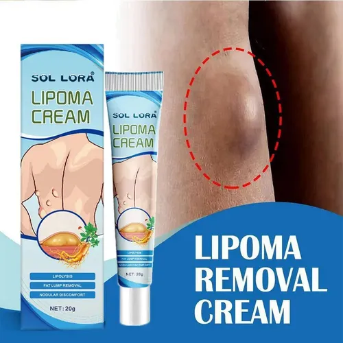 Crema Eliminación De Lipomas 20g2 Unidades –