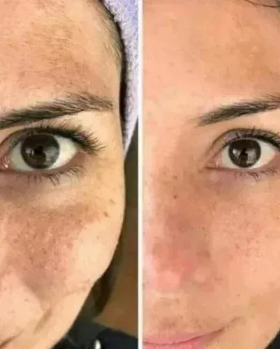 Ageloc Lumi Spa Limpiador Facial Inteligente Rose Gold