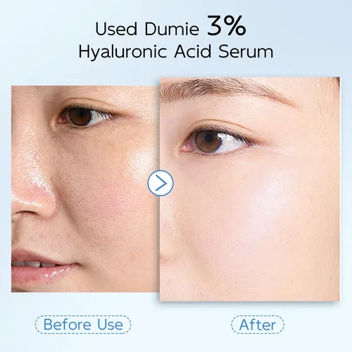 Sérum Facial De Ácido Hialurónico Al 3% Dumie, 30 Tubos Sensible Día/noche