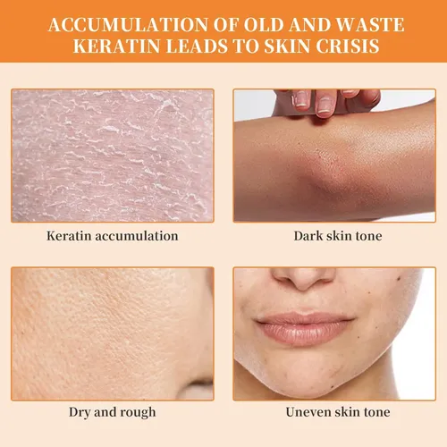 Gel Exfoliante, Elimina La Piel Muerta, Suaviza Y Tierna, 50 Ml Neutra
