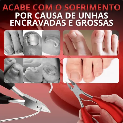 Cortador De Uñas Encarnadas Profesional Acero Inoxidable