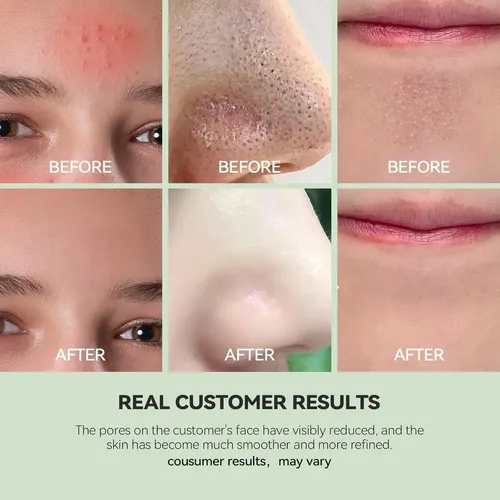 Mascarilla De Arcilla Limpiadora Wnp Con Niacinamida 100g