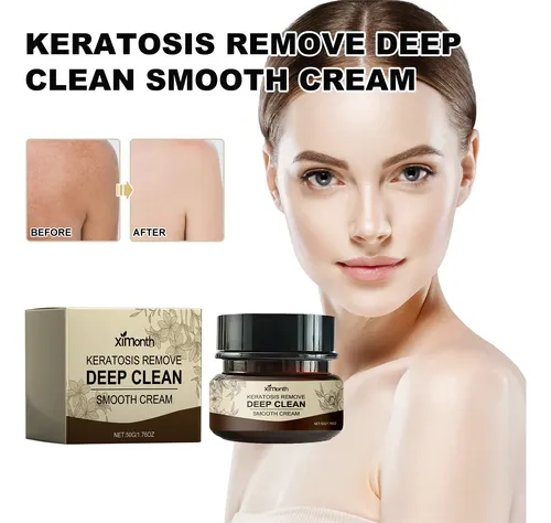 Crema Suave Y Limpiadora Profunda Ximonth Para Poros E Hidra