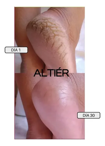 Altiér Crema Regeneración Intensiva Humectación Piel Seca