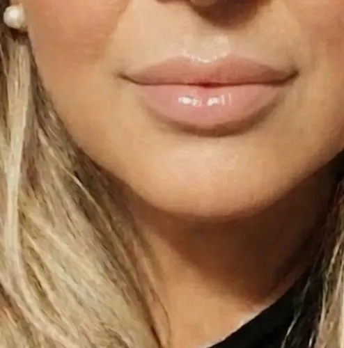 Lip Gloss Voluminizador Extreme Ble Lips