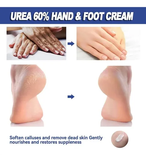 H Crema De Urea Al 60 Por Ciento For Los Pies Más Un 2%