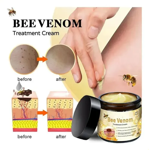 A Crema De Tratamiento Para La Piel De Abeja Pj //hy, All A