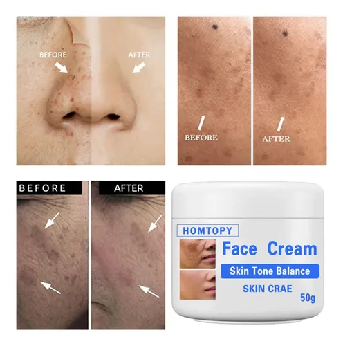 Crema Iluminadora Única Para Manchas Faciales, 50 G, Melasma