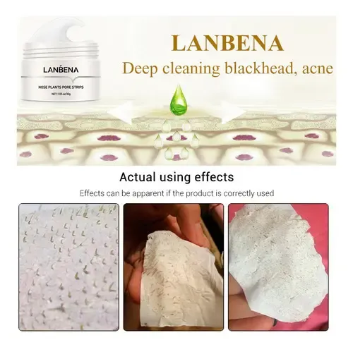 Lanbena Removedor De Puntos Negros 30g + 60 Pzs Papel