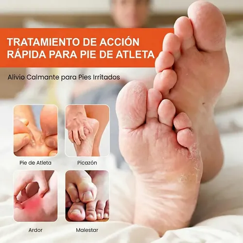Pomada Pie Atleta 20g Calma Picazon Bolso Gimnasio Viaje Neutra