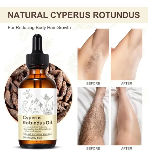 Aceite Inhibidor De Vello Cyperus Rotundus 2×