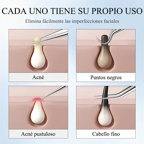 Pinzas Puntos Negros Ultrafina Precisión Acero Cejas Plateado Blackhead