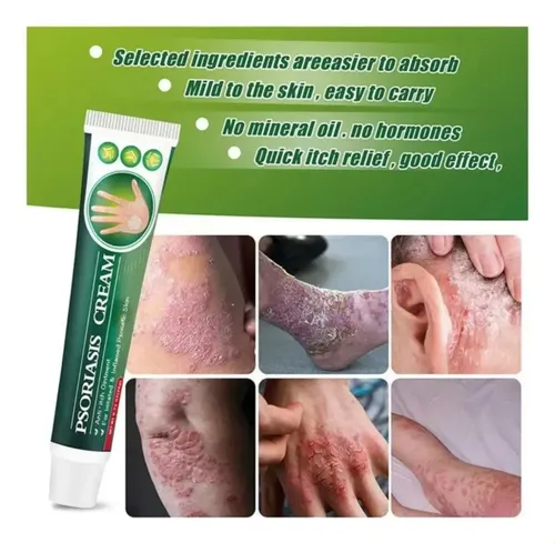 Crema Psoriásica I Skinmix, Crema Psoriásica Zlimplify, 2.