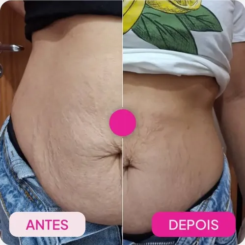 Cccrema Corporal De Frutos Rojos Lc Original Adeus Que Nutre
