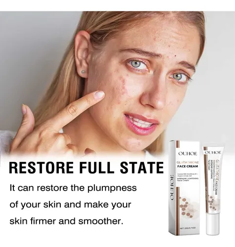 Crema Blanqueadora Hidratante For Aclarar Las Manchas