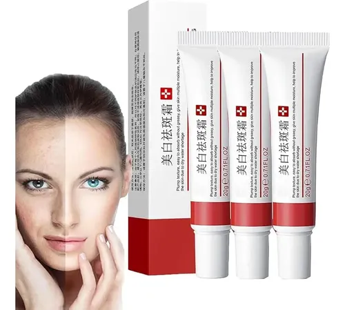Crema Para Manchas Oscuras En La Cara, Cremas Para Quitar