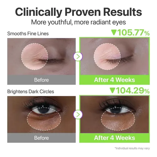 Serum Facial Retinal Liposomas 30ml Seoul 1988 Todo Tipo De Piel Día/noche