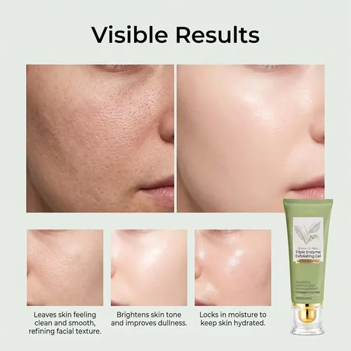 Gel Exfoliante Triple Enzimático, Removedor Suave De Piel Mu