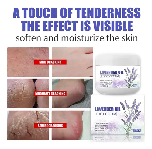 Crema De Pies Con Aceite De Lavanda For Agrietarse, 100 Ml