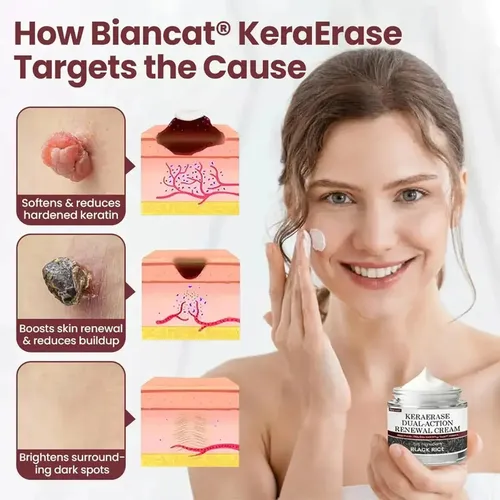 Crema Renovadora Biancat Keraerase De Doble Acción