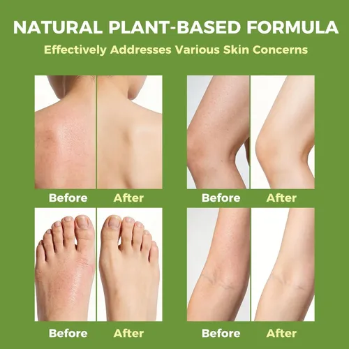 Árbol De Tè, Vegetal Tea Tree Oil, Limpieza Suave Para