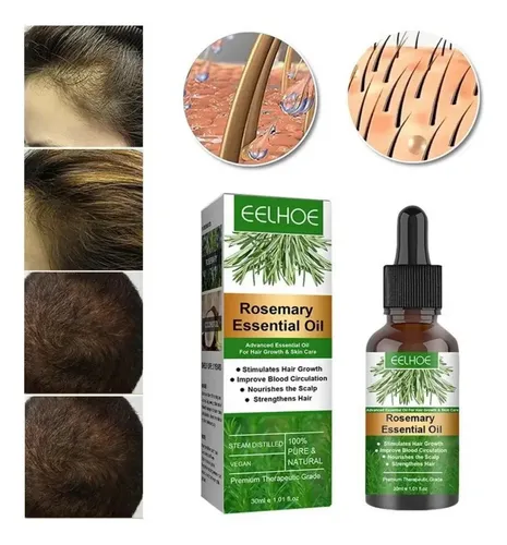 Aceite De Romero Para El Crecimiento Del Cabello, 30 Ml, Cre