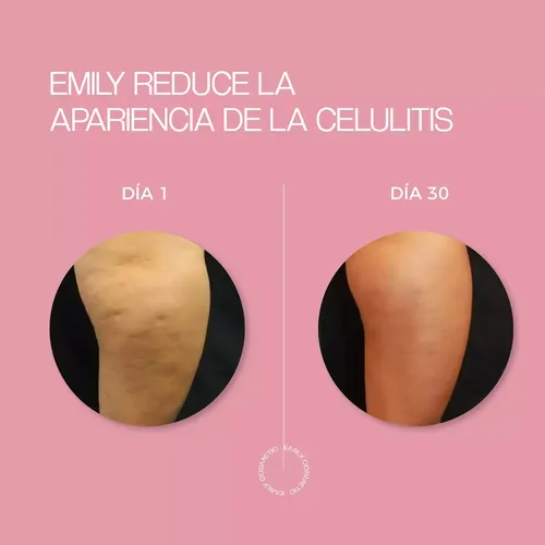 Combo X2 Crema Anticelulitis Emily – 200ml Fragancia Frutal