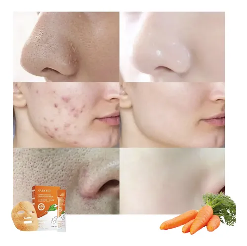 Mascarilla Facial Burbuja Zanahoria Ácido Salicílico X12