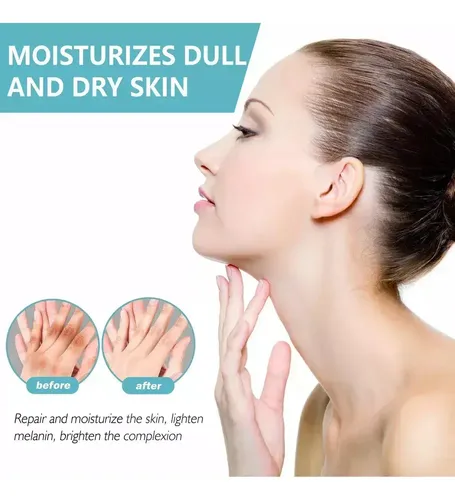 D Fixderma Nigrifix Crema Para Acantosis Nigricans Fbgxx