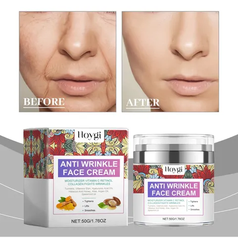 Crema Facial Hoygi Con Vitamina C Y Retinol