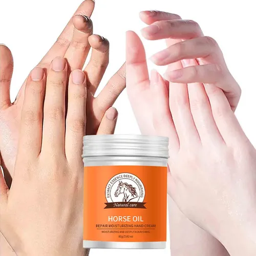 La Crema Antipecas Para Manos Restaura La Piel, Hidrata Y Pr