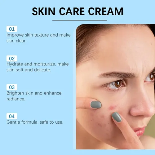 Crema Facial Para Acné Con 20% De Ácido Azelaico, Sérum De Á