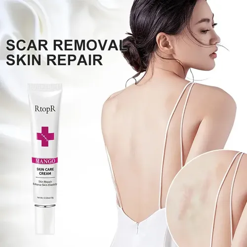 Crema Para Cicatrices Manchas Quemaduras Estrias Acne New!