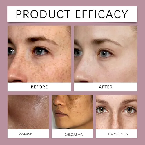 Crema Facial Iluminadora Y Correctora De Manchas Eelhoe
