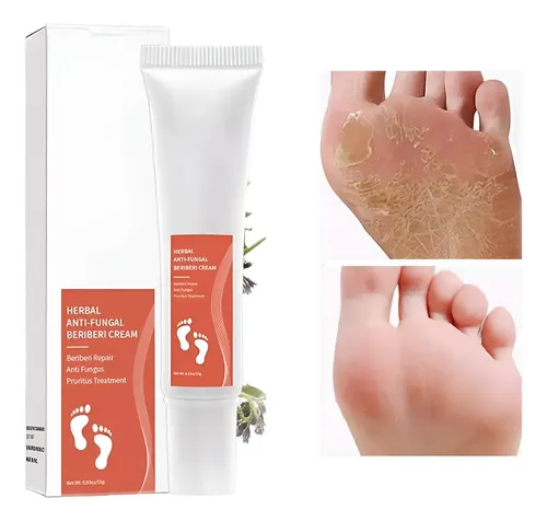 Crema Suero Antiinfección Pies Efectiva Hongos Onicomicosis