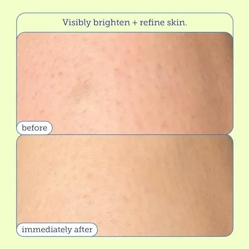 Exfoliante Y Exfoliante Corporal Skinfix Resurface+ Glycolic