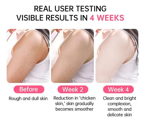 Crema Reparadora Urea 25% Para Piel Seca Y Áspera Joypretty Fragancia Neutra