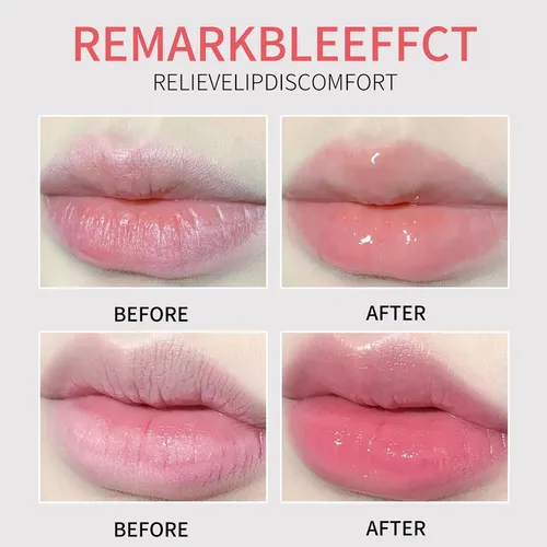 Mascarilla Hidratante Para Renovar Los Labios Secos Y Agriet