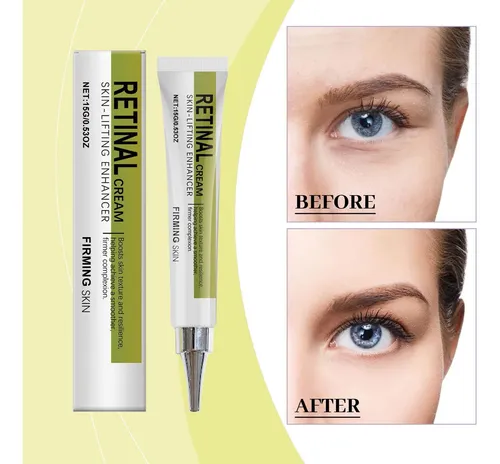 Crema Facial Antiarrugas Y Reafirmante Adecuada Para Una Nut