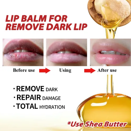 L/x Bálsamo Labial Para Labios Oscuros, Arrugas Labiales Y