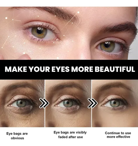 3×útil Tensor Ojos Instantáneo,la Mejor Crema For Bolsas .