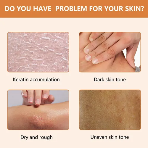 Gel Exfoliante De Naranja Para Rostro Y Cuerpo, Gel Exfolian